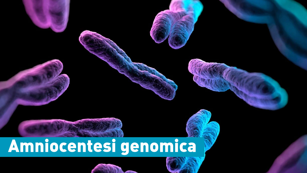Amniocentesi genomica