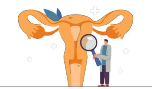 Fibromi uterini - Villa Donatello