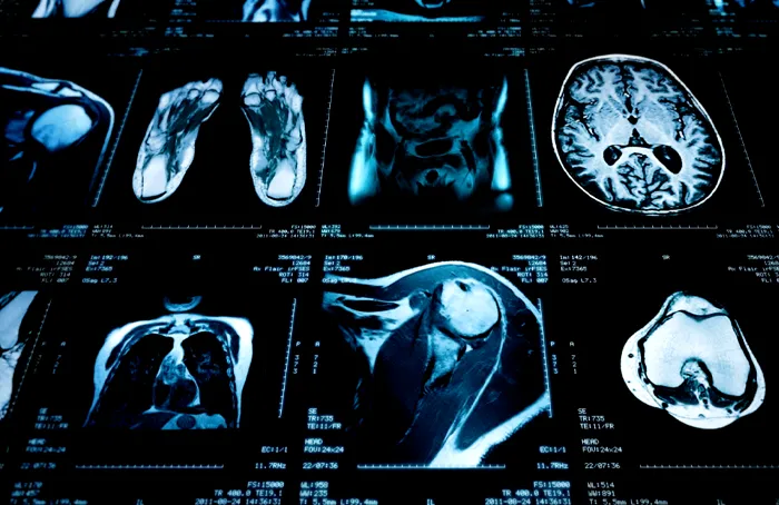 Risonanza Magnetica Total Body - Villa Donatello