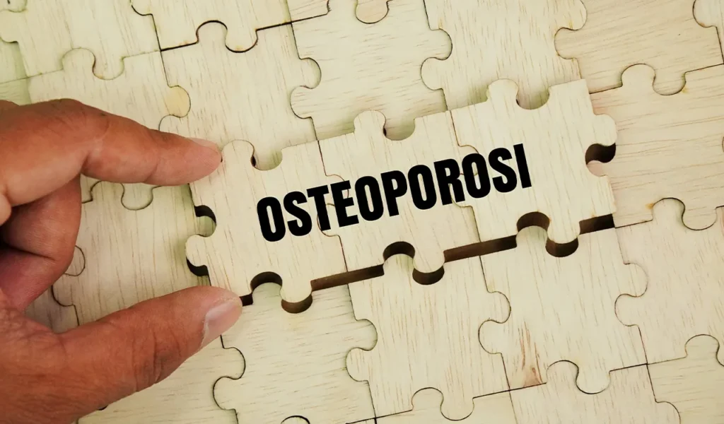 Osteoporosi Villa Donatello