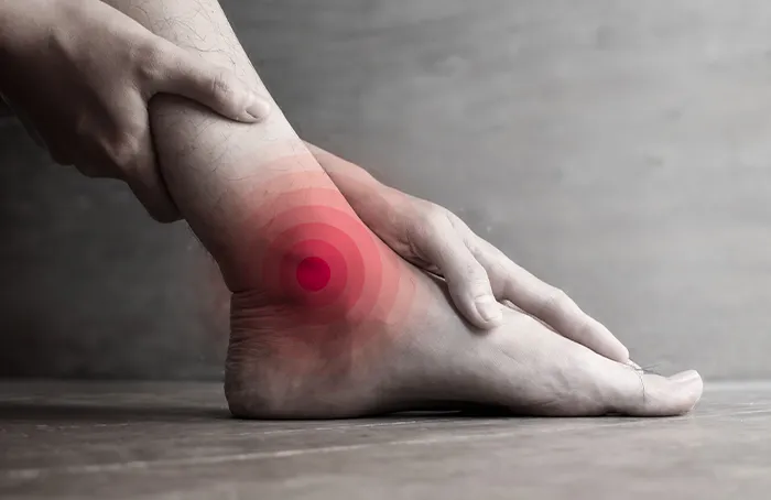 Artrosi Caviglia - Villa Donatello